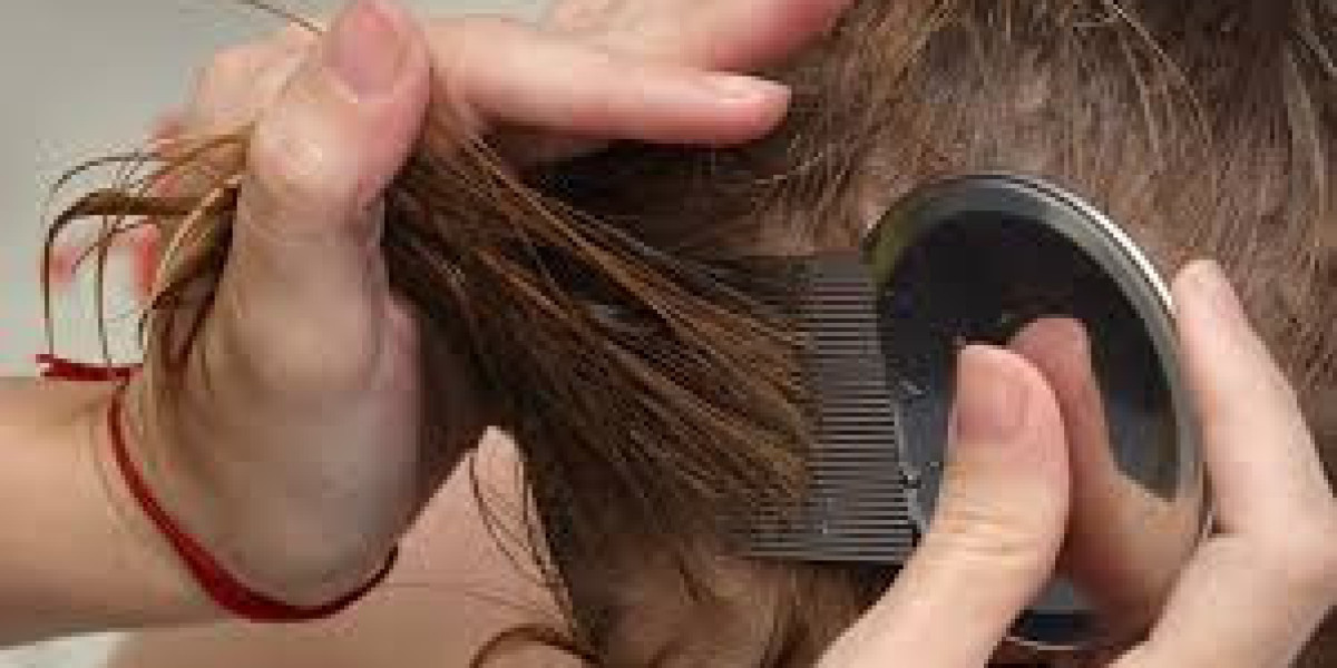 Top 10 Most Effective Lice Treatments for Kids and Adults